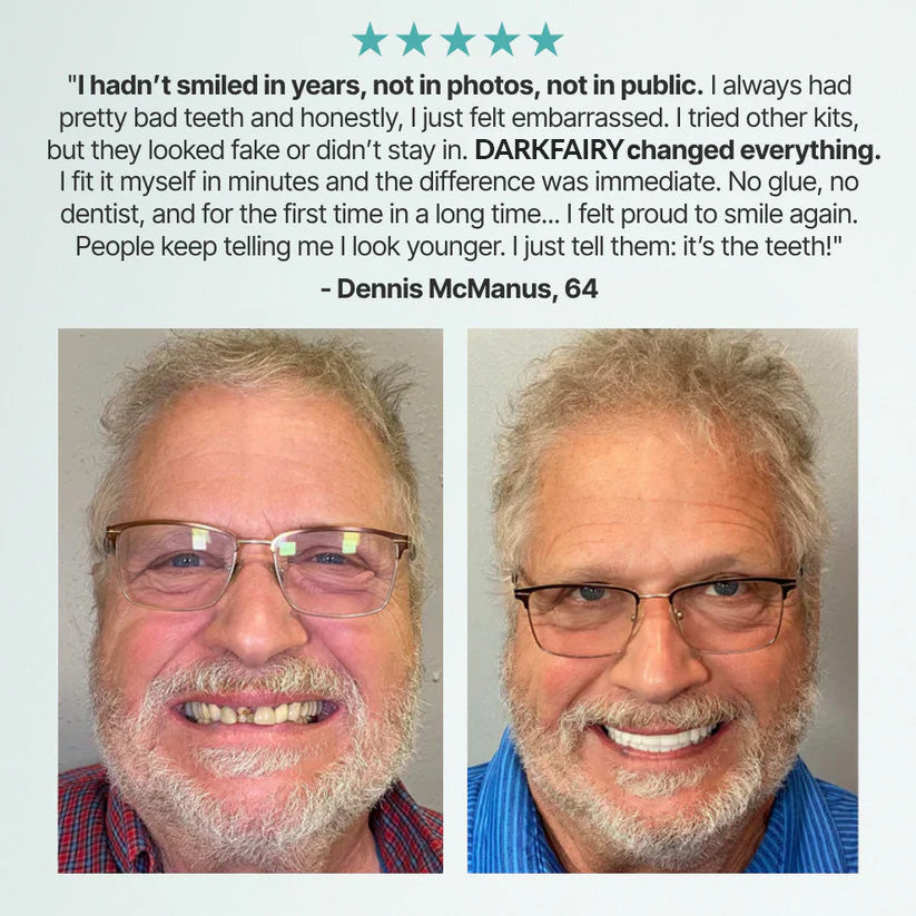 🏆Ends Today: 70% OFF! 🏆2026 Bestselling Product🦷 Fit for a Fresh Smile, Say Goodbye to Wearing Discomfort!🌎