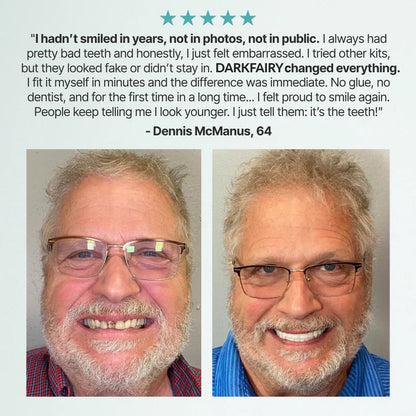 🏆Ends Today: 70% OFF! 🏆2026 Bestselling Product🦷 Fit for a Fresh Smile, Say Goodbye to Wearing Discomfort!🌎