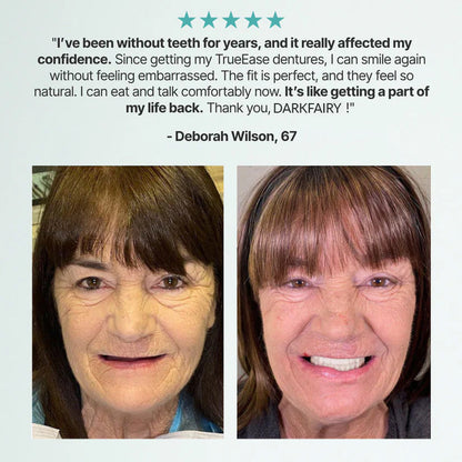 🏆Ends Today: 70% OFF! 🏆2026 Bestselling Product🦷 Fit for a Fresh Smile, Say Goodbye to Wearing Discomfort!🌎
