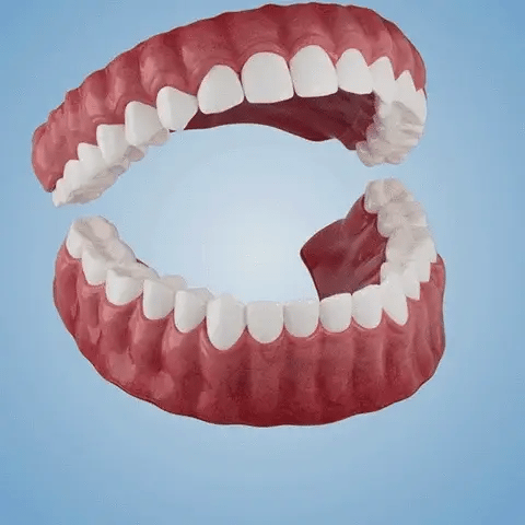 🏆Ends Today: 70% OFF! 🏆2026 Bestselling Product🦷 Fit for a Fresh Smile, Say Goodbye to Wearing Discomfort!🌎